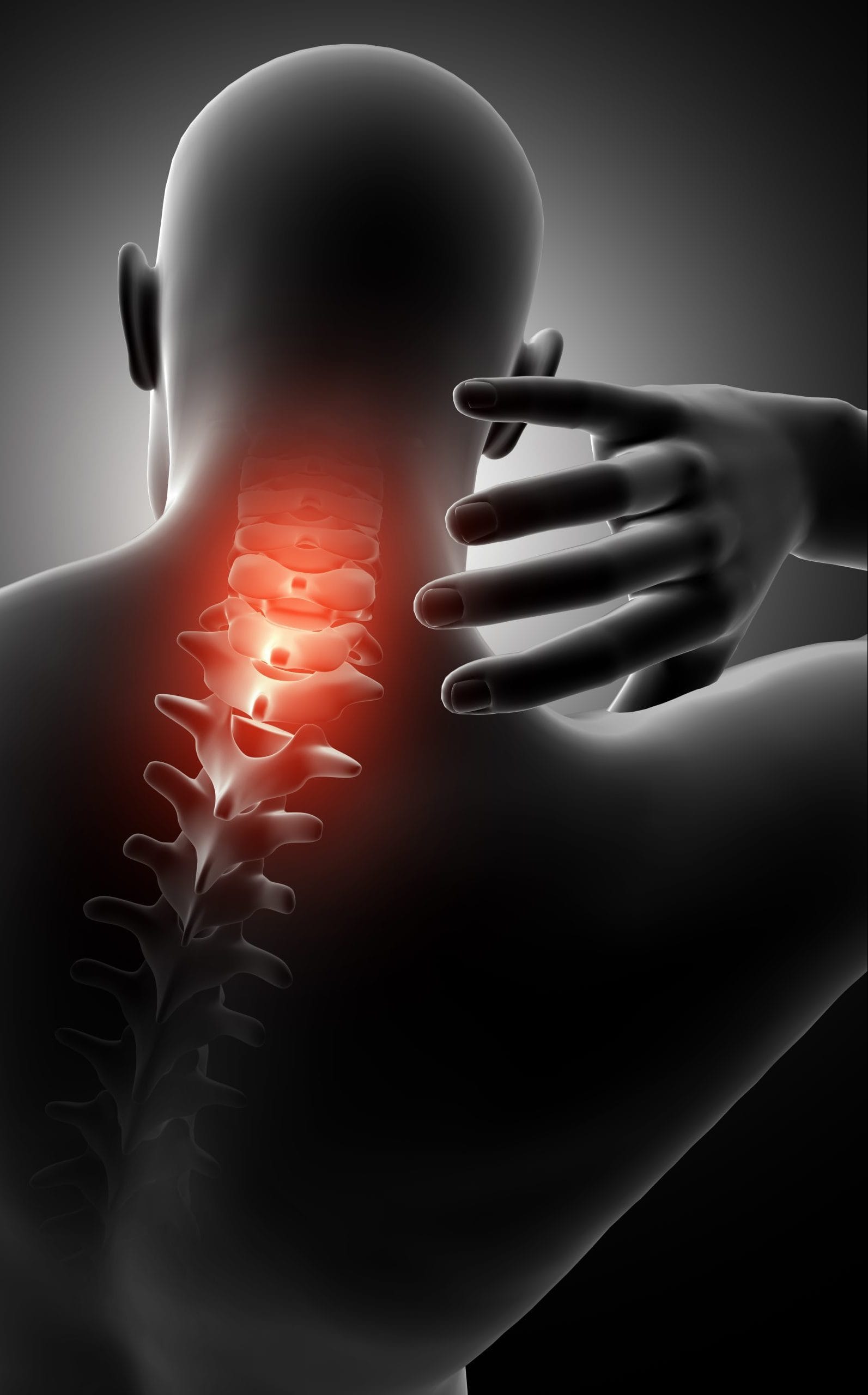 3D render of a male figure with neck highlighted in pain